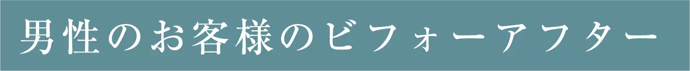 男性のお客様のビフォーアフター